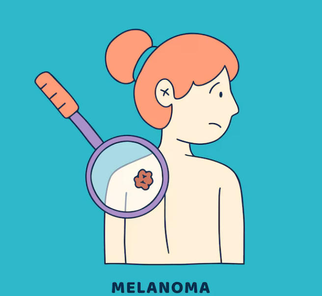 Skin Cancer Diagnosis